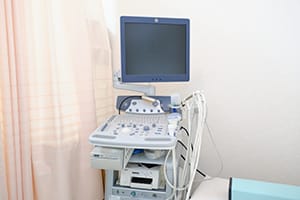 超音波診断装置